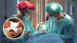 Pig Kidney: सूअर की लगवाई किडनी फिर भी हो गई मौत 1 image 116